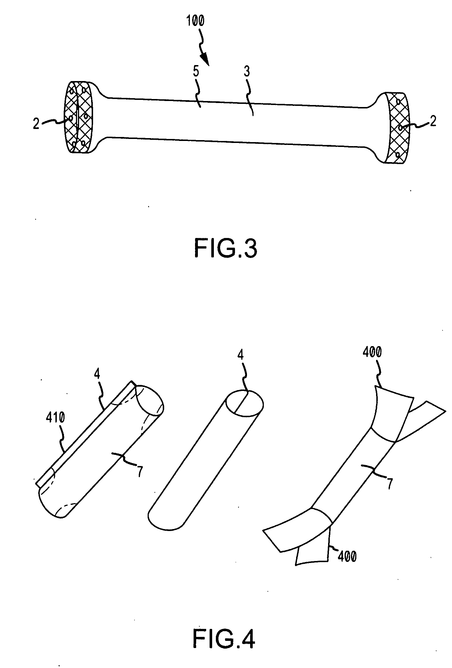 Venous prosthesis and vascular graft with access port