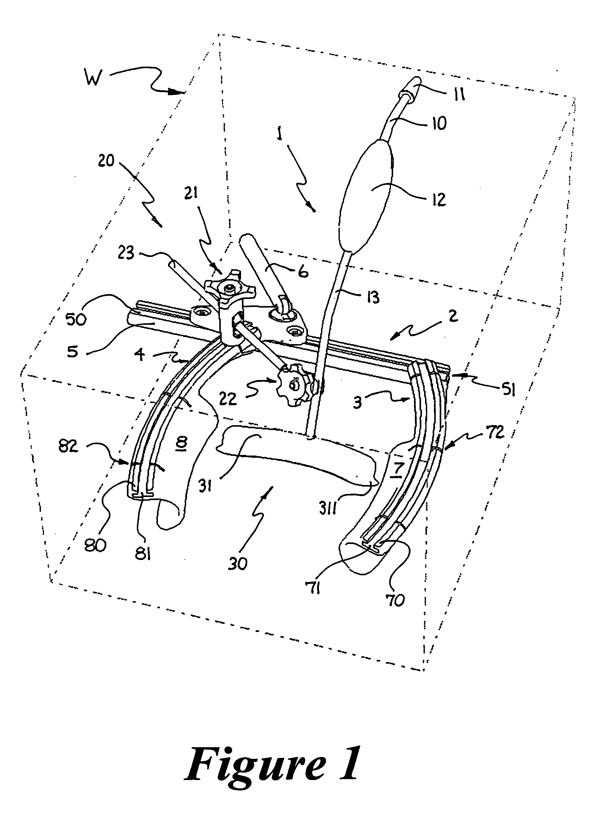 Surgical device and method for pericardium retraction