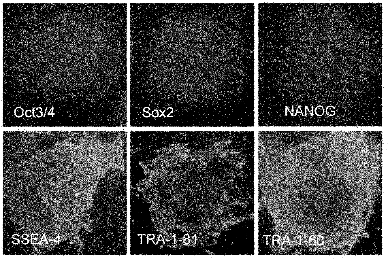 Method for culturing human artificially induced pluripotent stem cells by using human amnion mesenchyme cells as culture layer