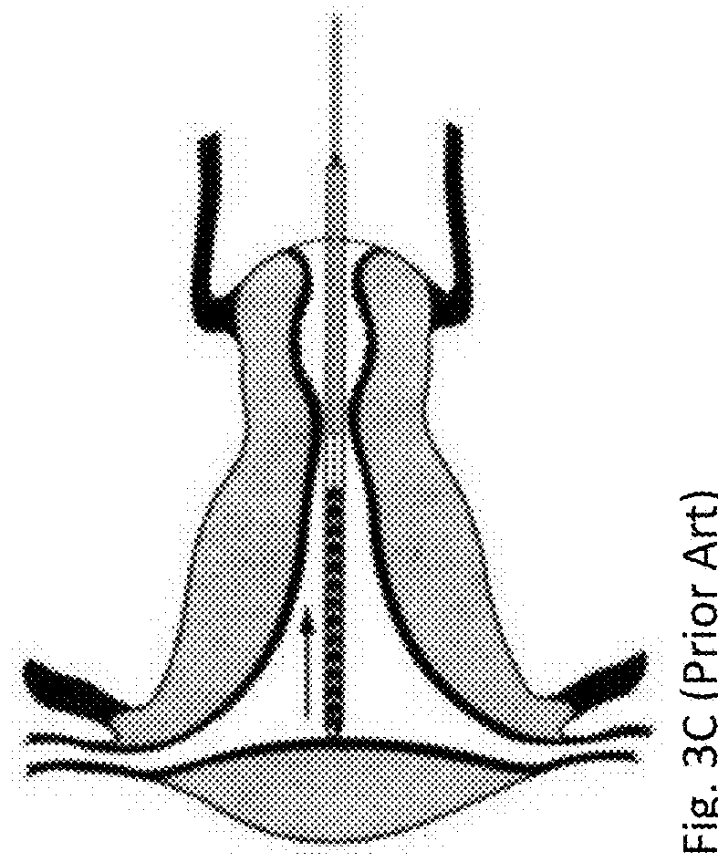 Brush biopsy device, kit and method