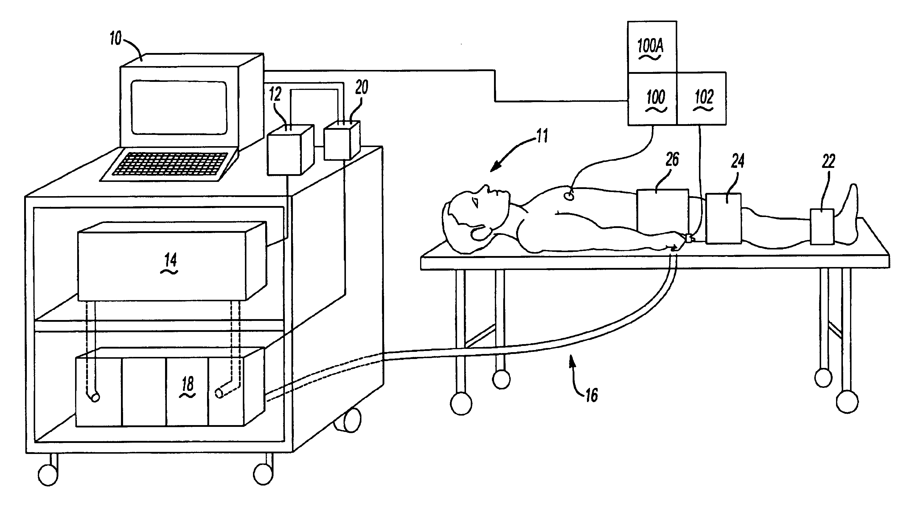 Computer-based control for a counterpulsation device using noncompressed air