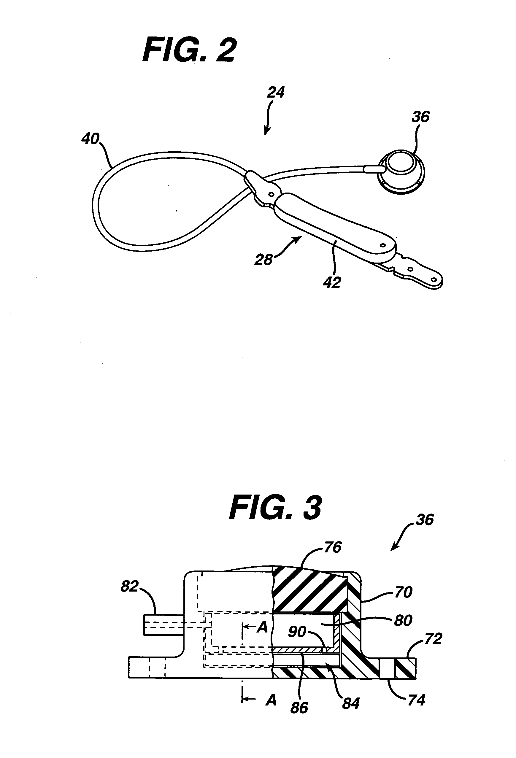 Remote monitoring and adjustment of a food intake restriction device