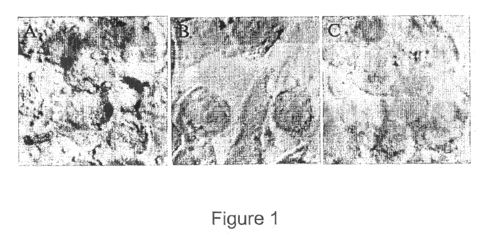 Method of inhibiting infection by HCV, other flaviviridae viruses, and any other virus that complexes to low density lipoprotein or to very low density lipoprotein in blood preventing viral entry into a cell