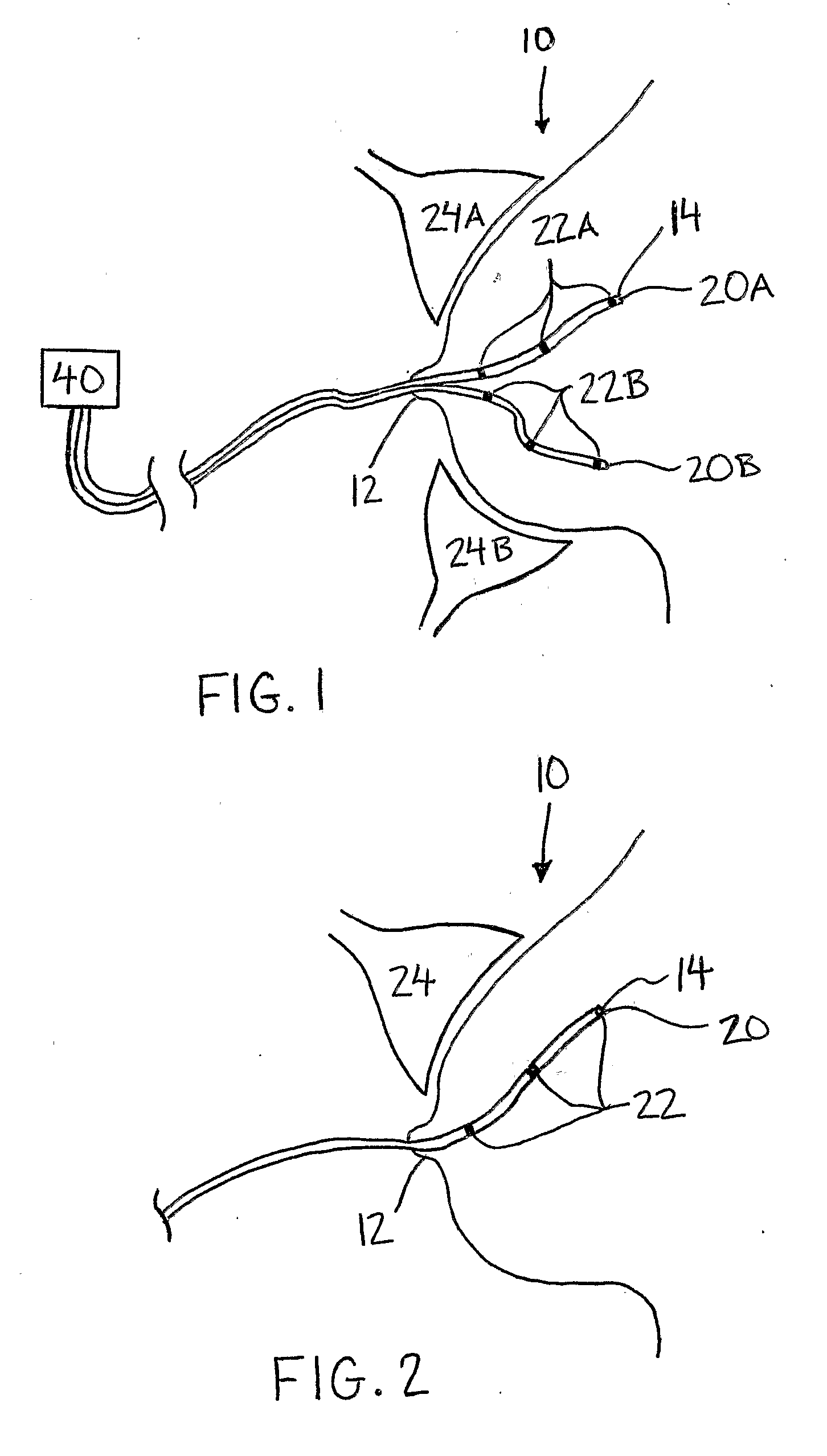 System and Micro-Catheter Devices for Medical Imaging of the Breast