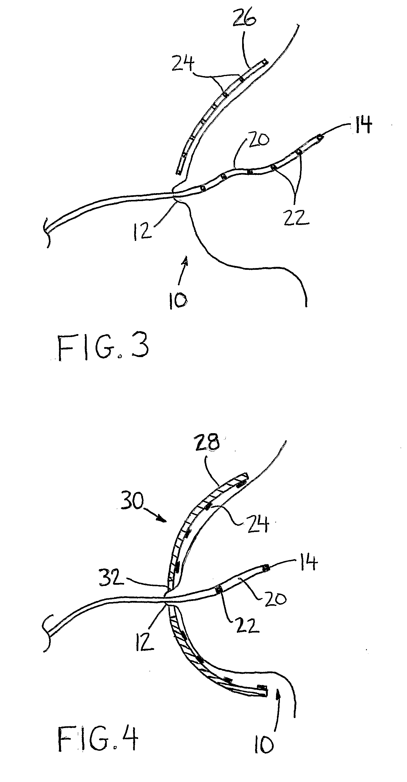 System and Micro-Catheter Devices for Medical Imaging of the Breast