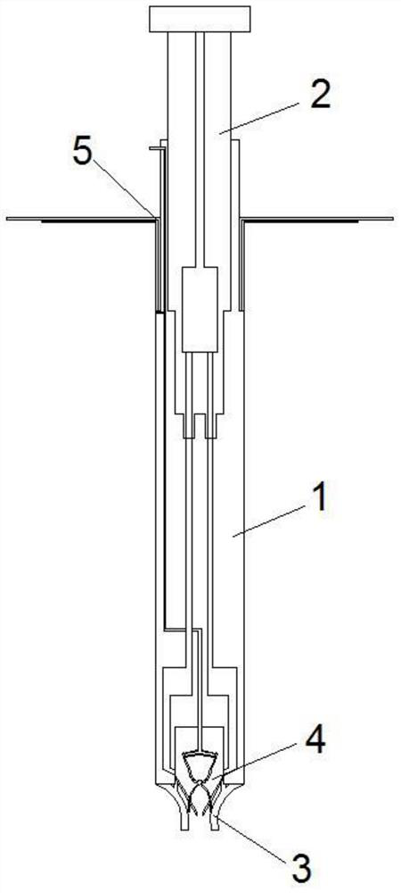 Double-tube type drainage preset tube for abdominal cavity perfusion