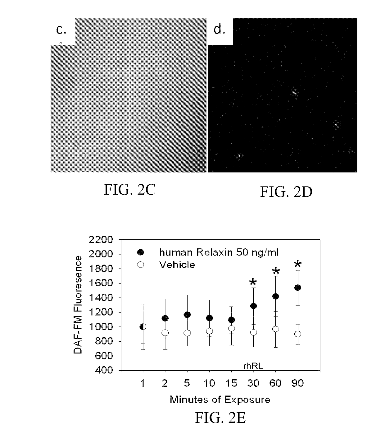 Materials and methods for modulating activity of bone marrow derived cells