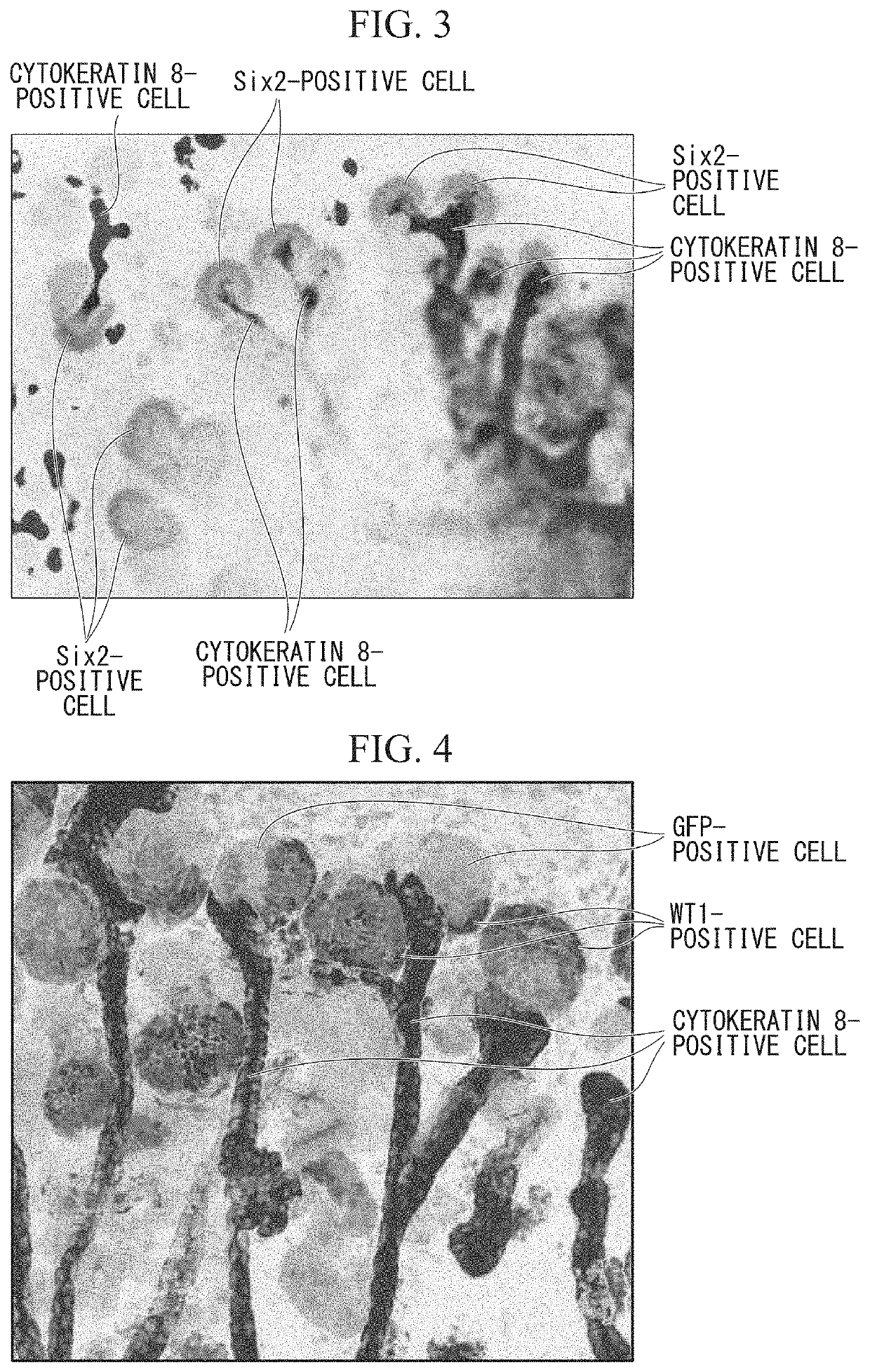 Kidney production method