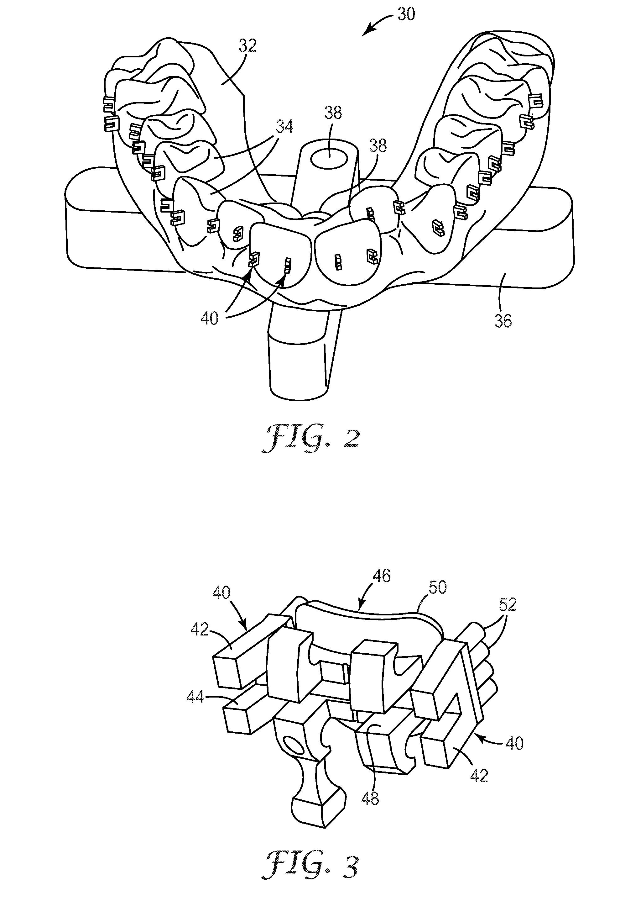 Indirect bonding trays for orthodontic treatment and methods for making the same