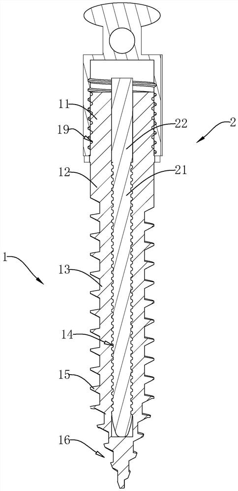 screw for medical device