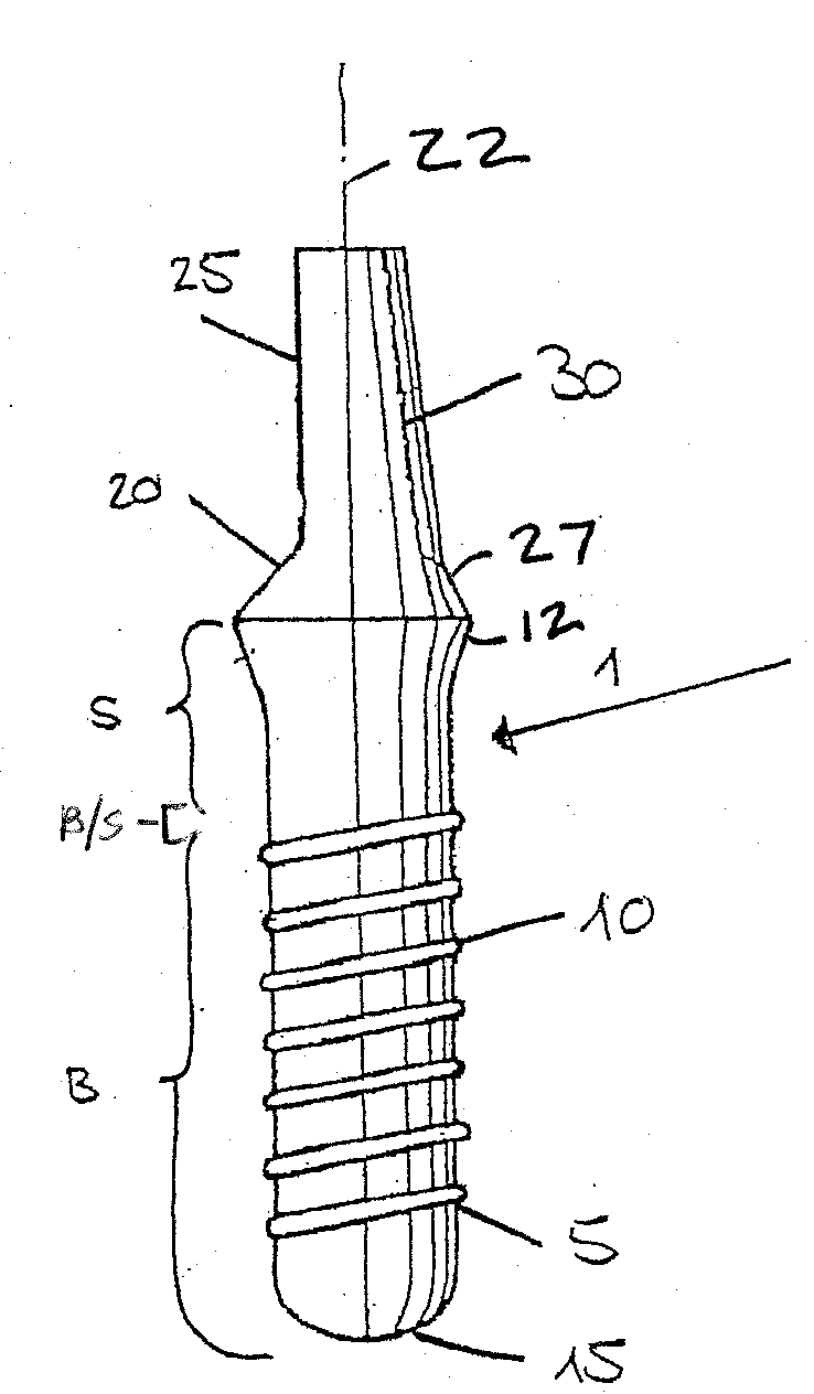 One-Part Implant with a Hydroxylated Soft Tissue Contact Surface