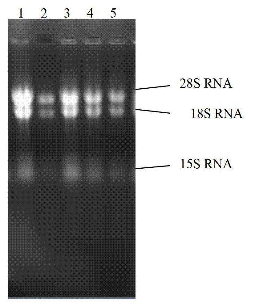 Cordyceps sinensis ribonucleotide reductase as well as coding gene and application thereof