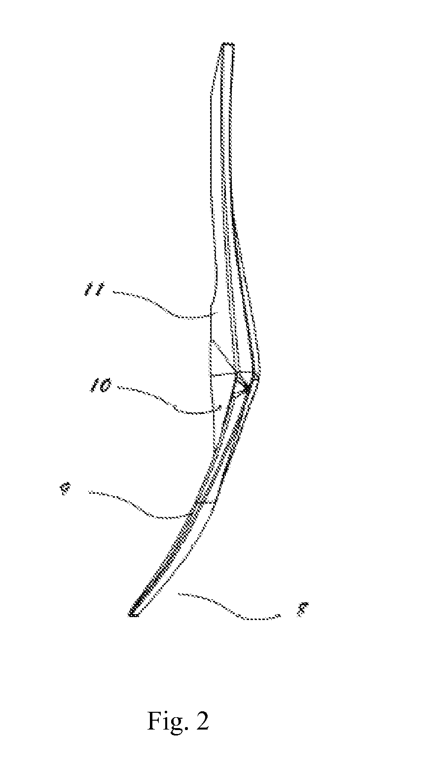 Multi-Functional Ladle