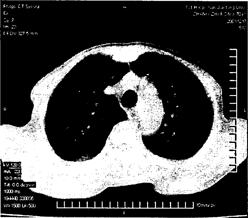 Automatic generating method for colour multi-window CT image