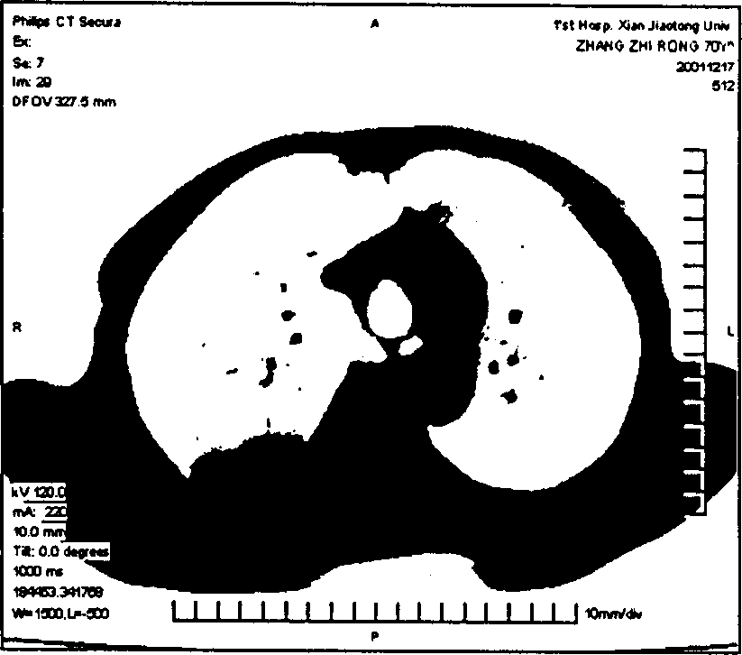 Automatic generating method for colour multi-window CT image