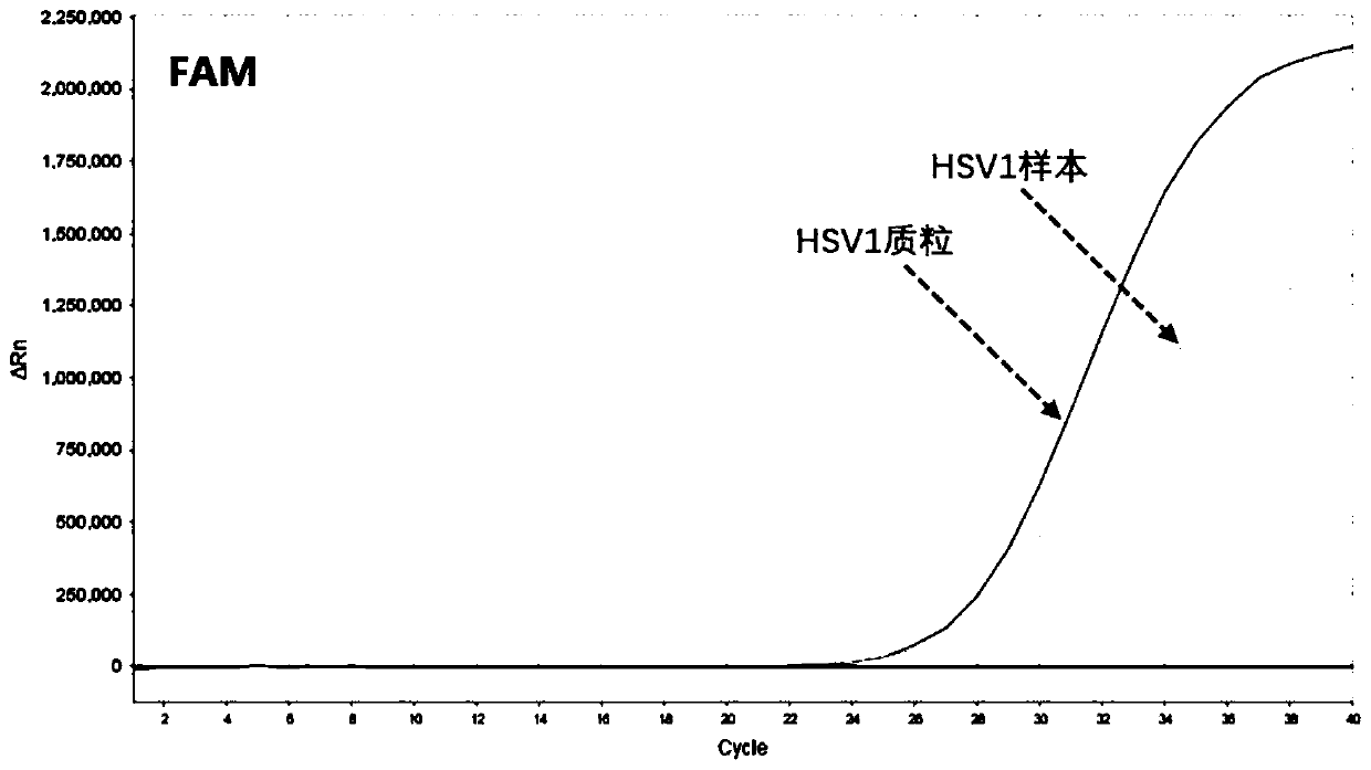 Human herpesvirus I/II/III/V type nucleic acid typing detection kit and detection method