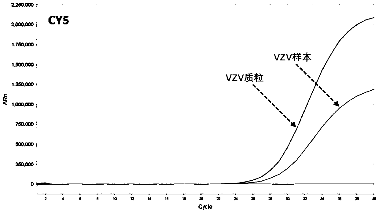 Human herpesvirus I/II/III/V type nucleic acid typing detection kit and detection method