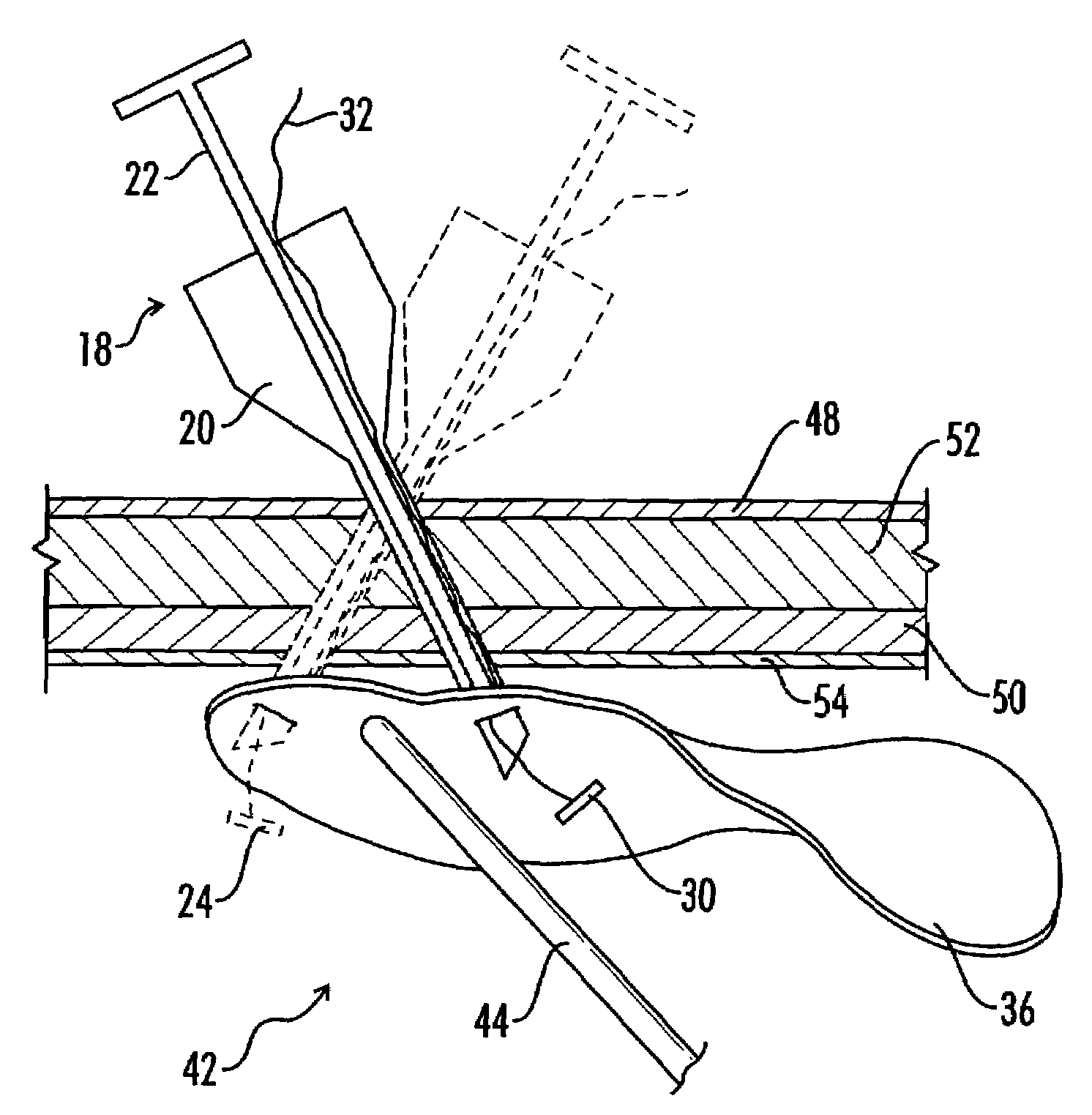 Device and method for surgical repair of abdominal wall hernias