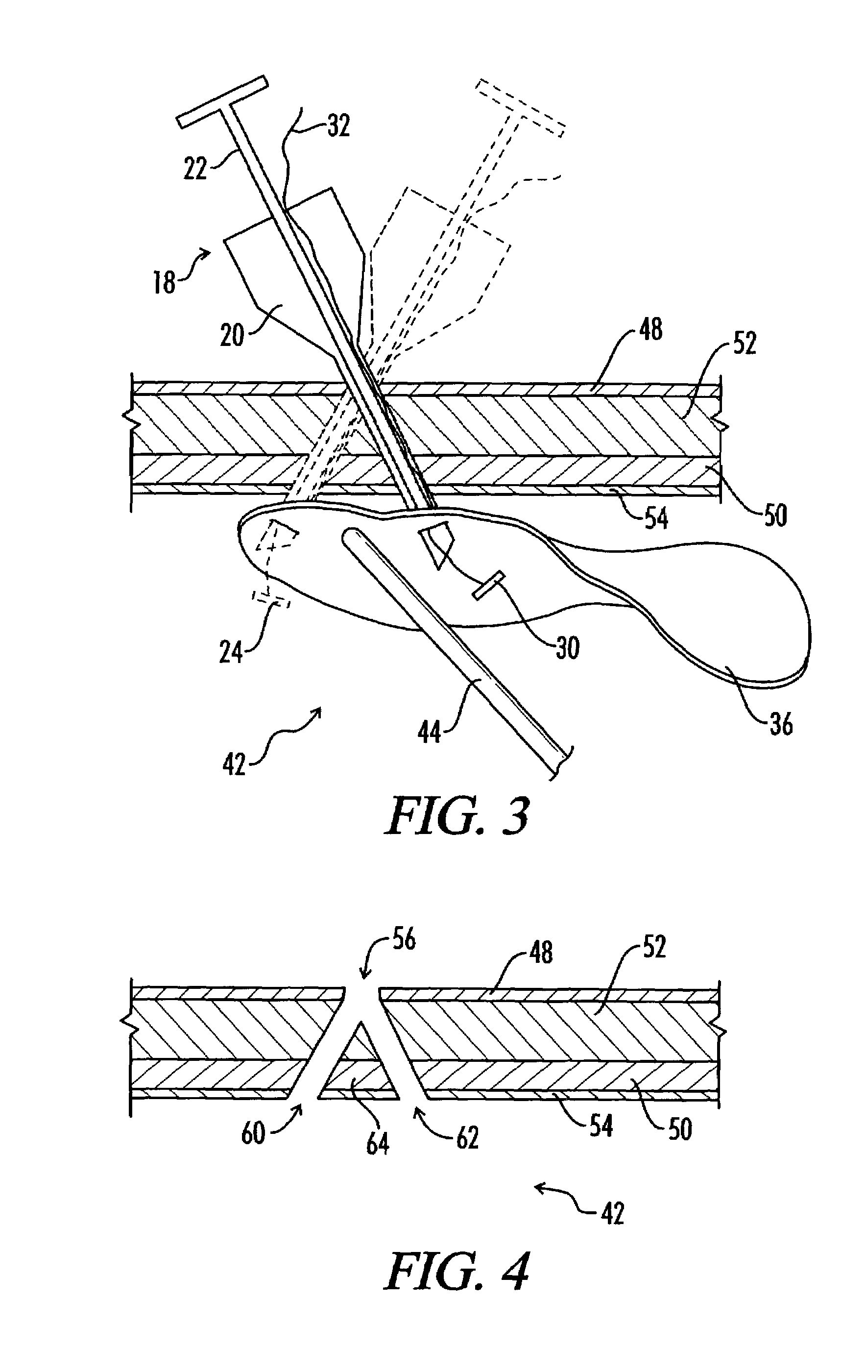 Device and method for surgical repair of abdominal wall hernias