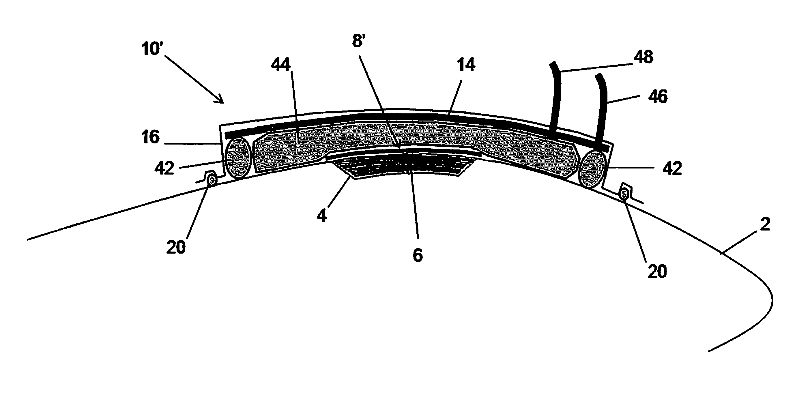 Systems and methods for on-aircraft composite repair using double vacuum debulking