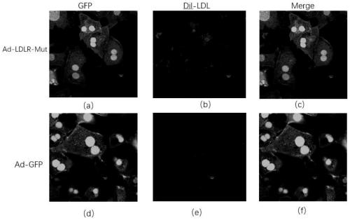 Exosome of LDLR mutant, preparation method of exosome, and application of exosome in preparing drug against hyperlipidaemia