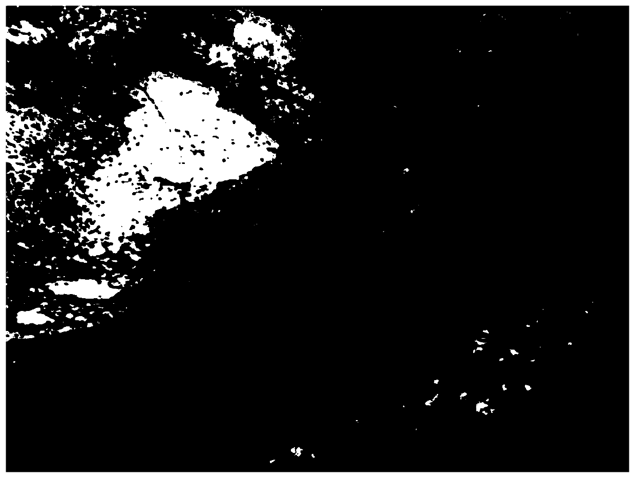 Auxiliary analysis method and system for pathological image of thyroid cancer cells based on deep learning