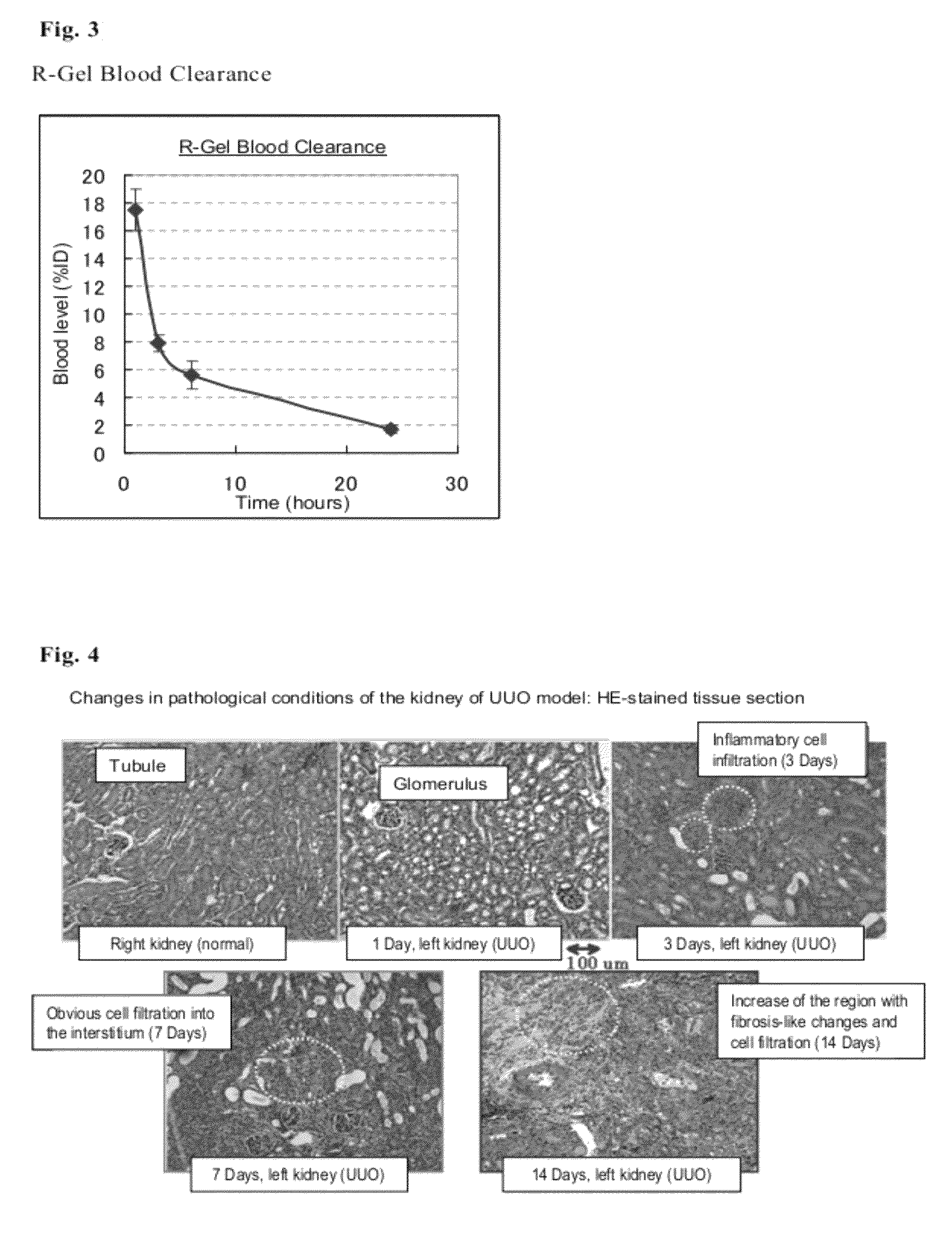 Kidney-imaging agent comprising recombinant gelatin