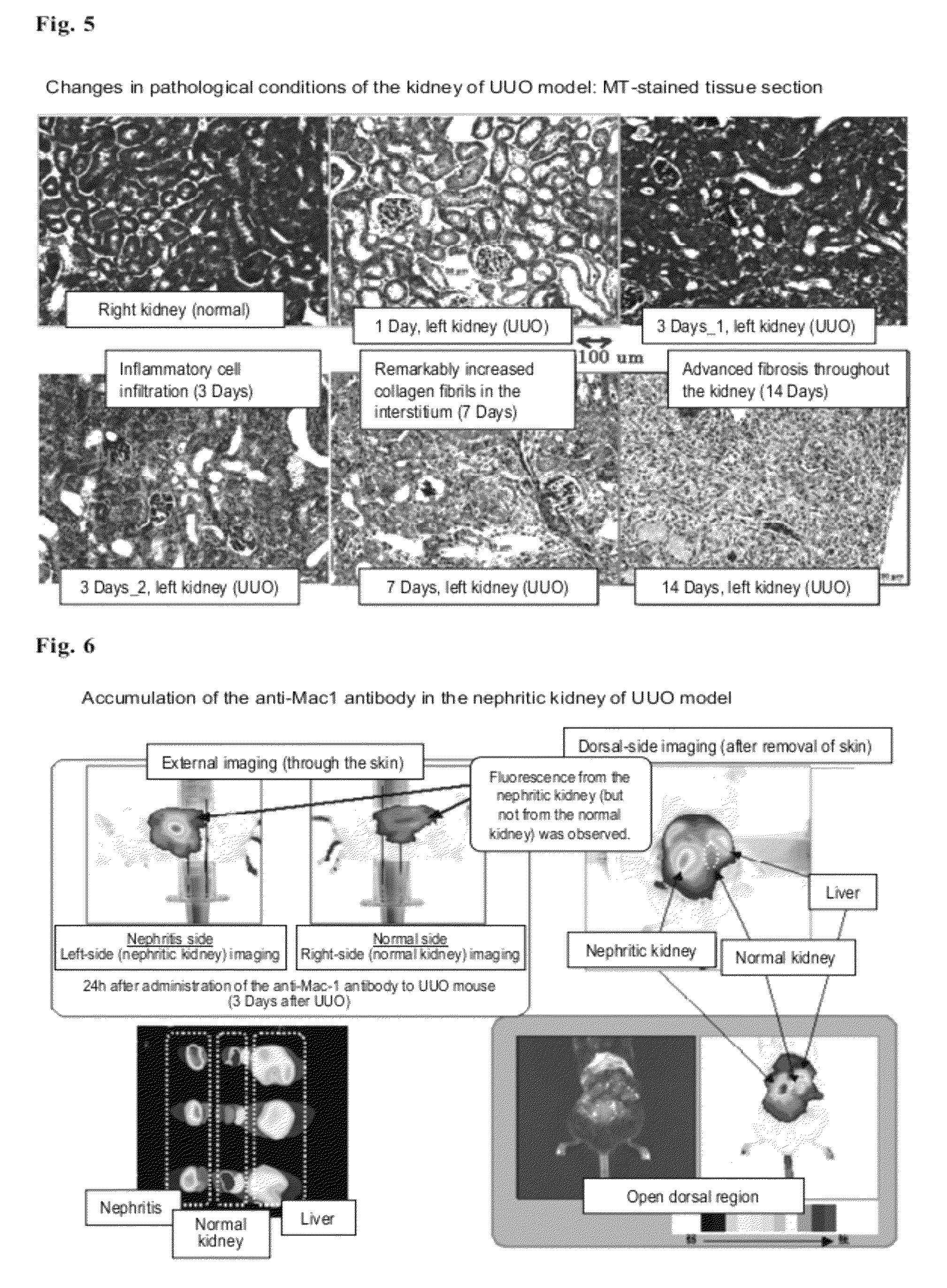 Kidney-imaging agent comprising recombinant gelatin