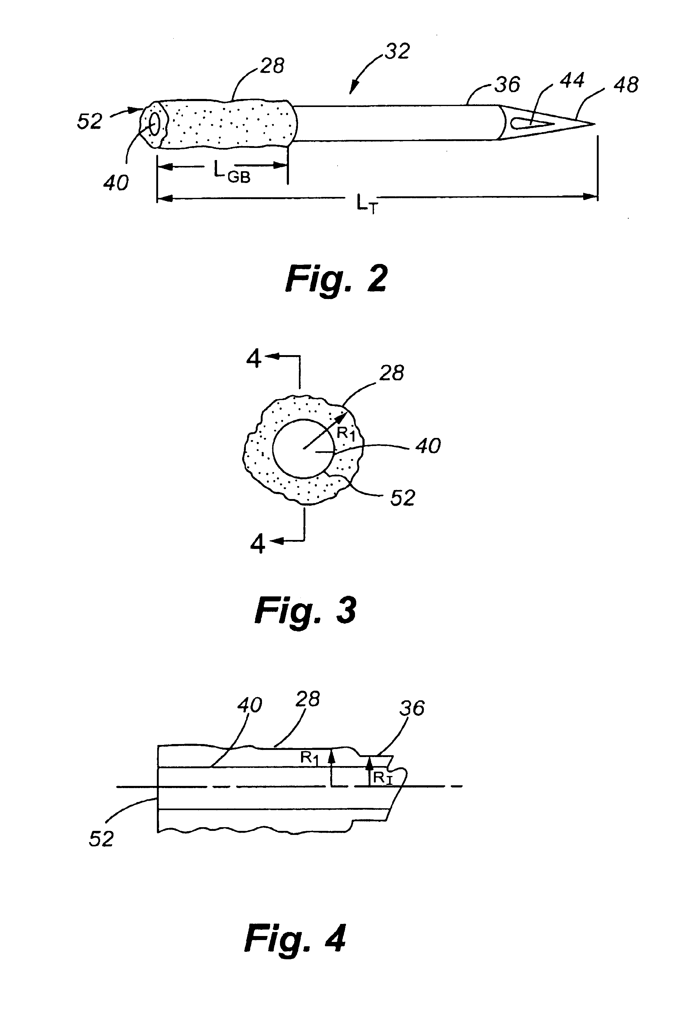Method for manufacturing a cannula assembly