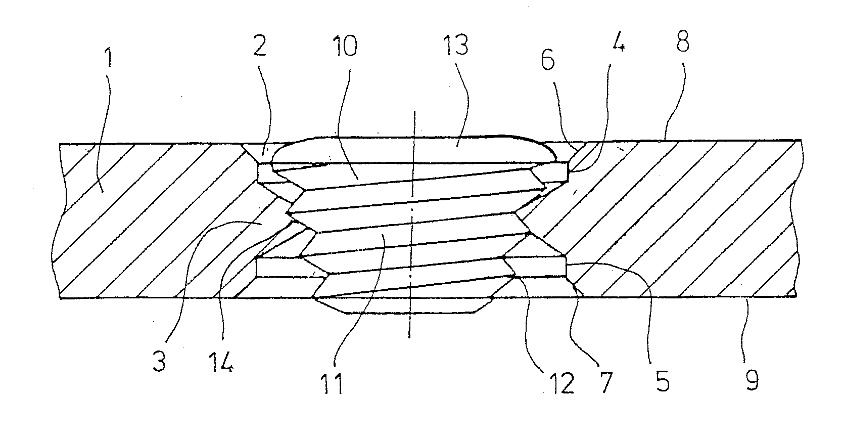 Bone-Fixation System and Filler Element for Bone-Fixation