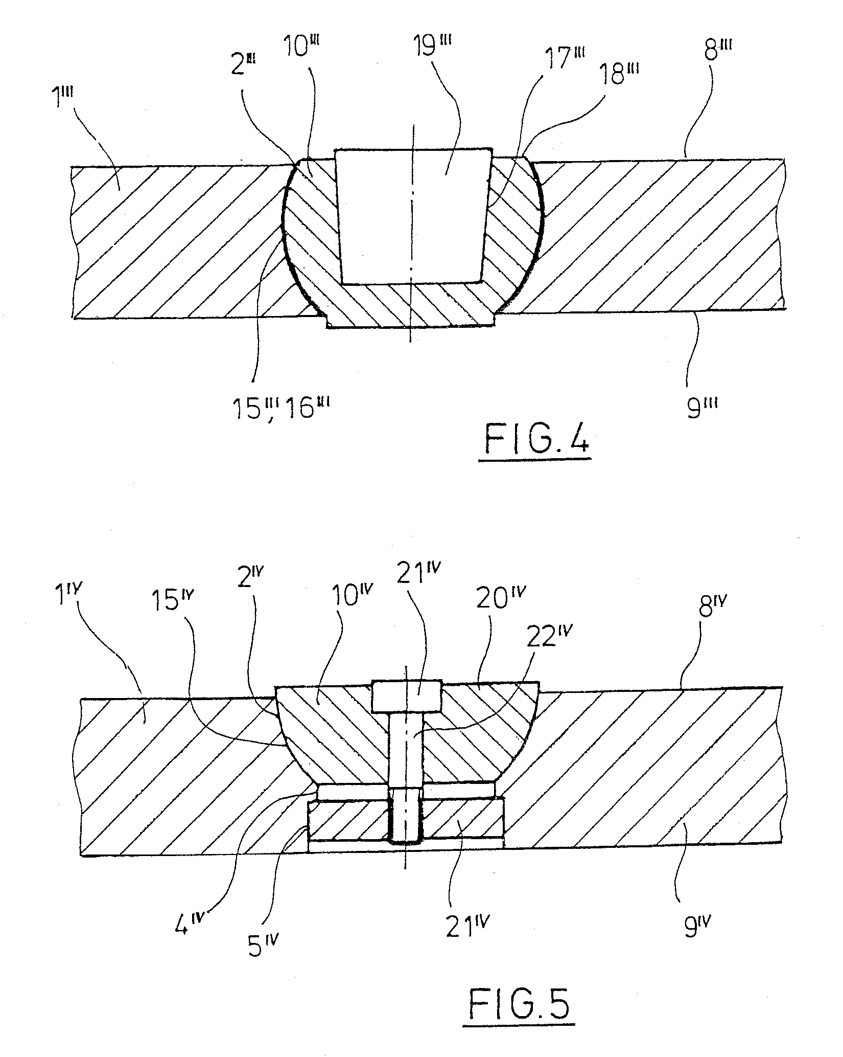 Bone-Fixation System and Filler Element for Bone-Fixation