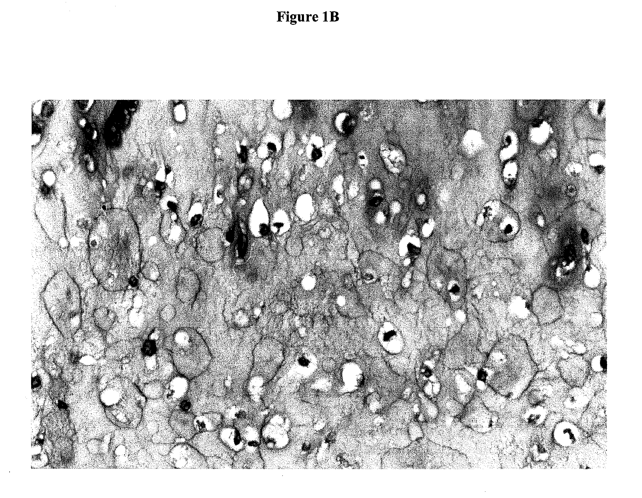 Intervertebral disc