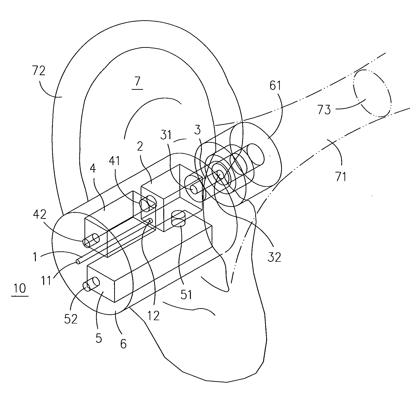 Noise reduction device and method thereof