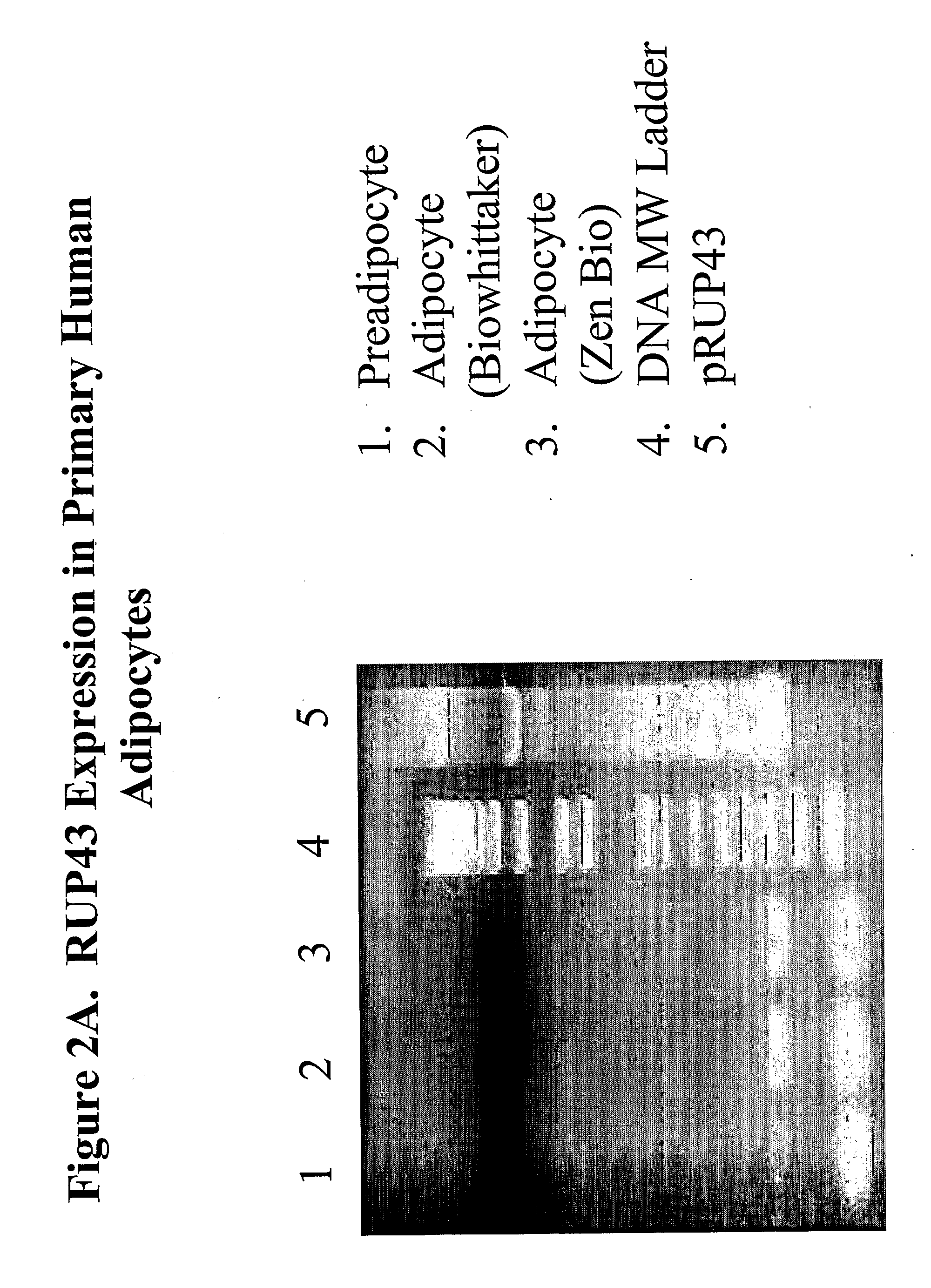 Human G Protein-Coupled Receptor and Modulators Thereof for the Treatment of Hyperglycemia and Related Disorders