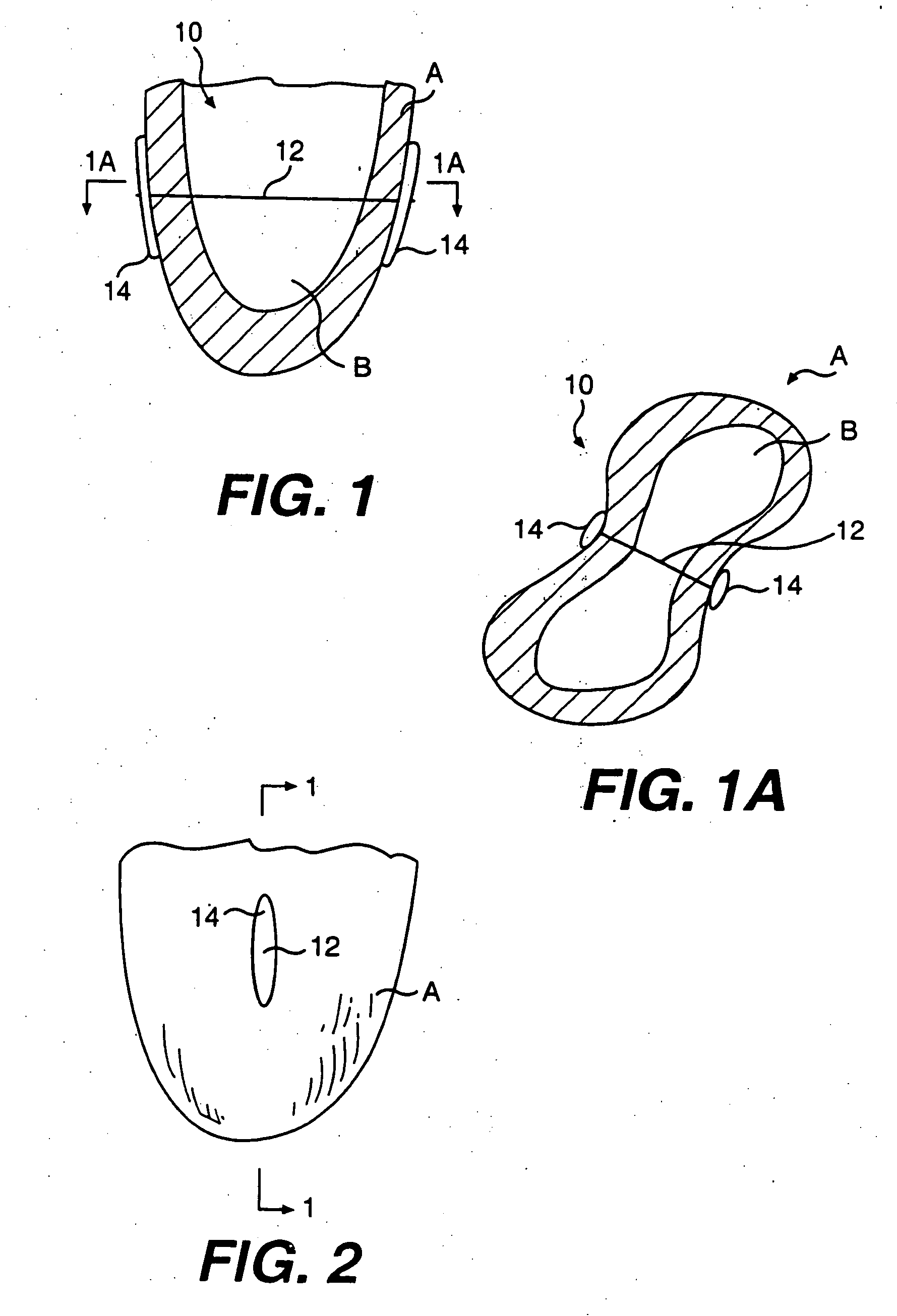 Transventricular implant tools and devices