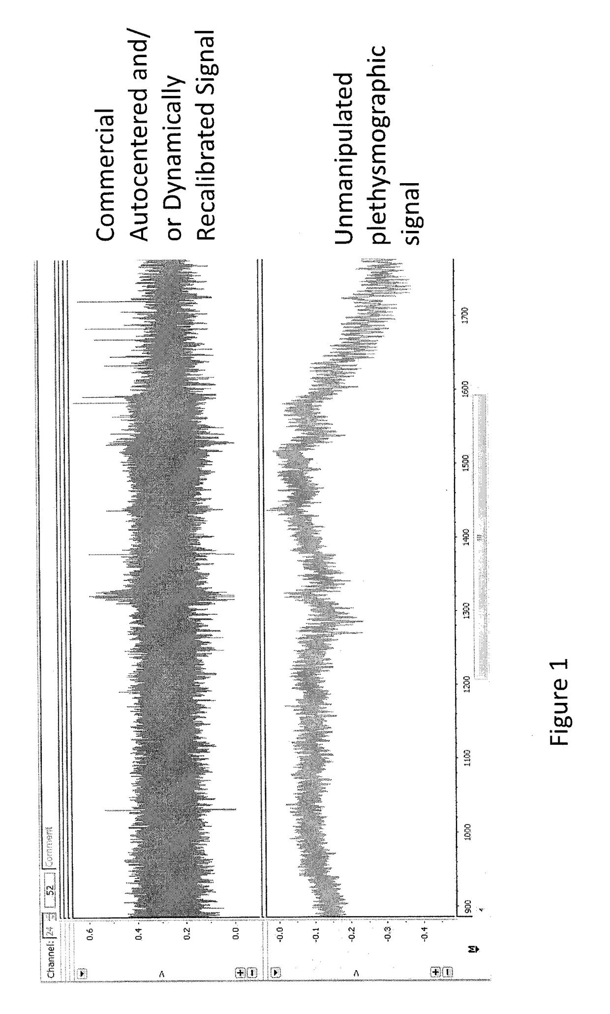 Method and system enabling photoplethysmograph measurement of volume status