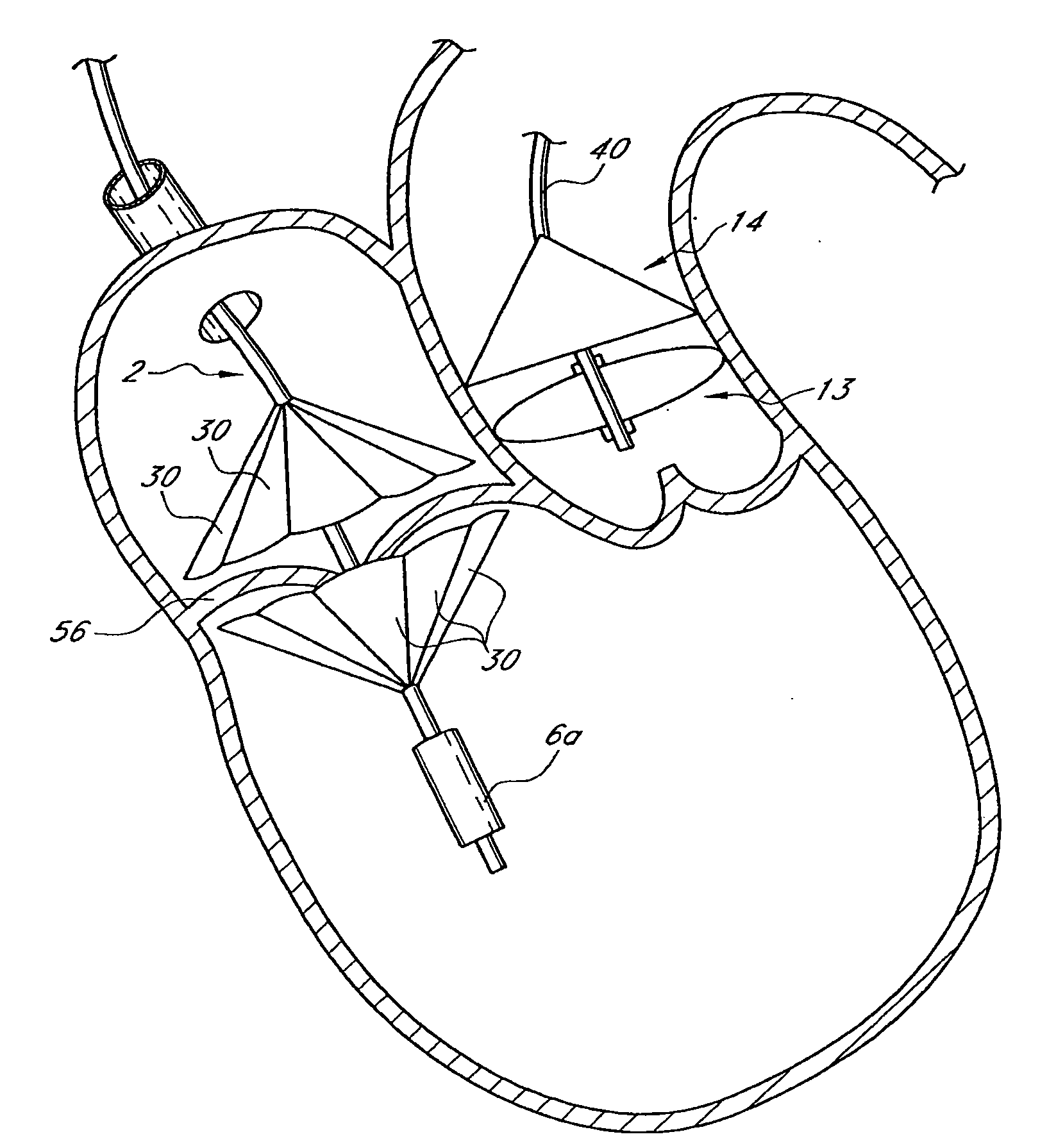 Prosthetic Valve for Transluminal Delivery