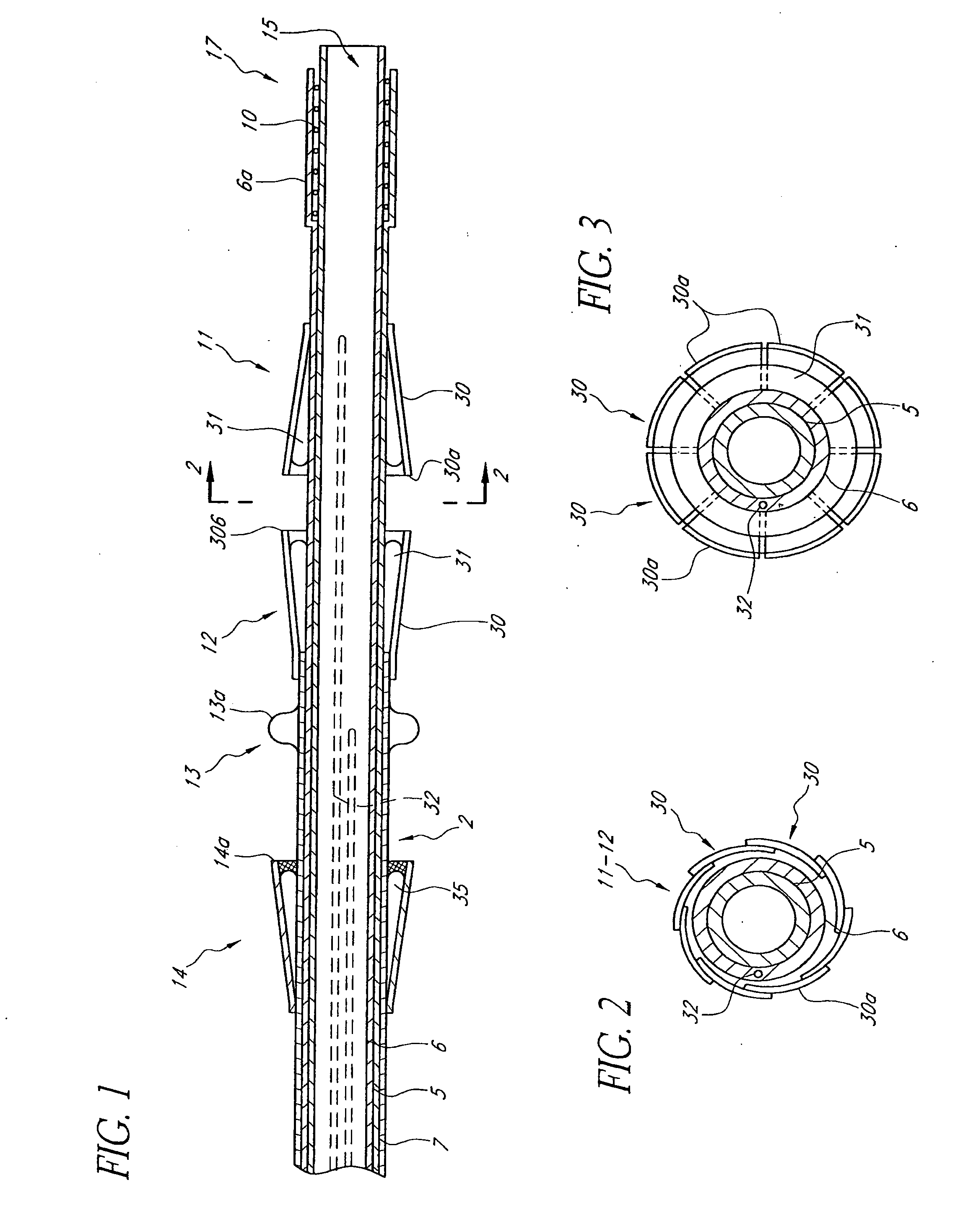 Prosthetic Valve for Transluminal Delivery