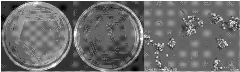 A strain of Micromonospora actinomycete, and applications thereof