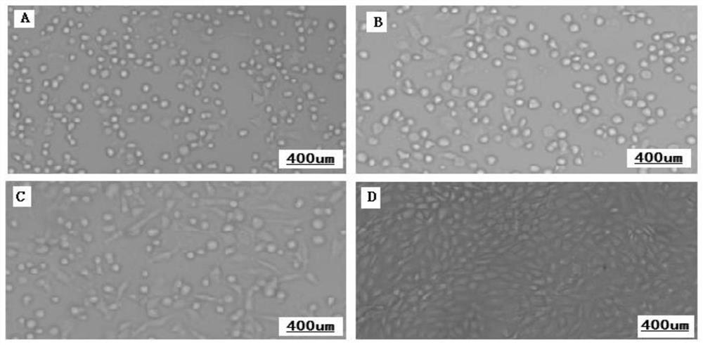 Lamb testicular sertoli cell immortalized cell line and its establishment method and application