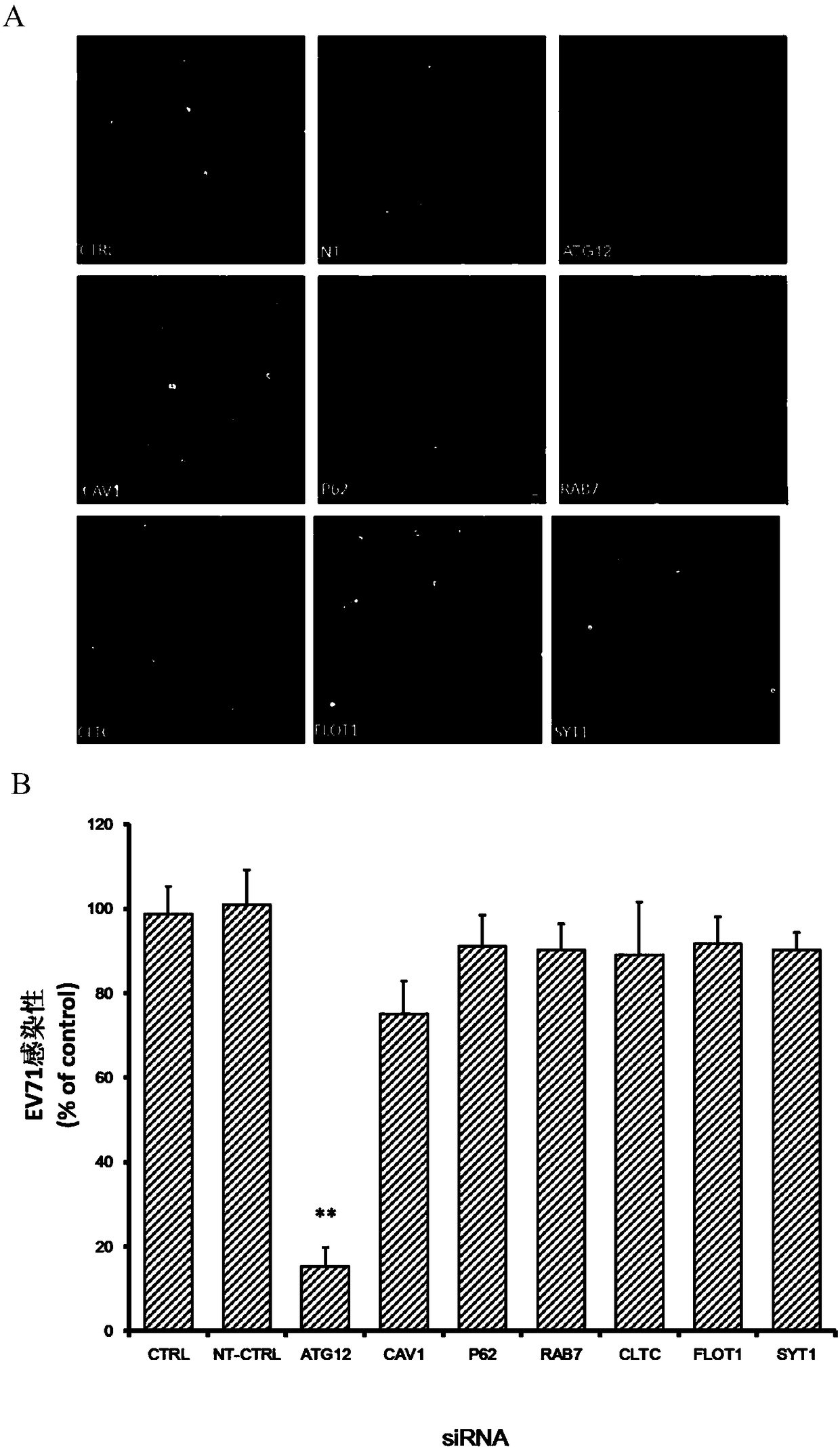 Application of autophagy-related protein 12 in the prevention and treatment of enterovirus 71 infection