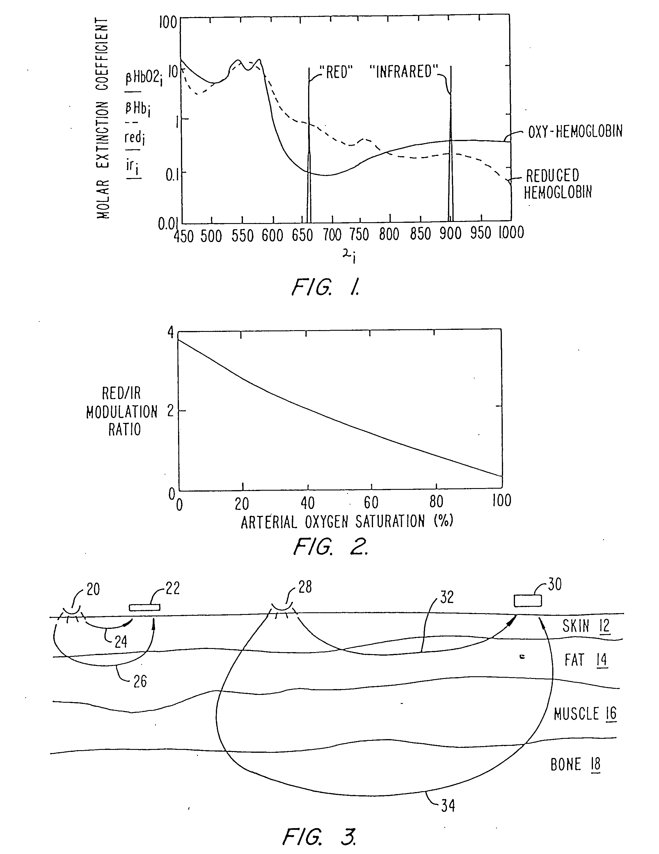 Pulse oximeter and sensor optimized for low saturation