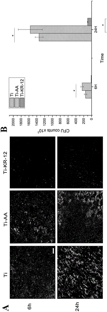 Infection preventing and osteoblast differentiation promoting antibacterial peptide modified titanium alloy prosthesis and making method thereof