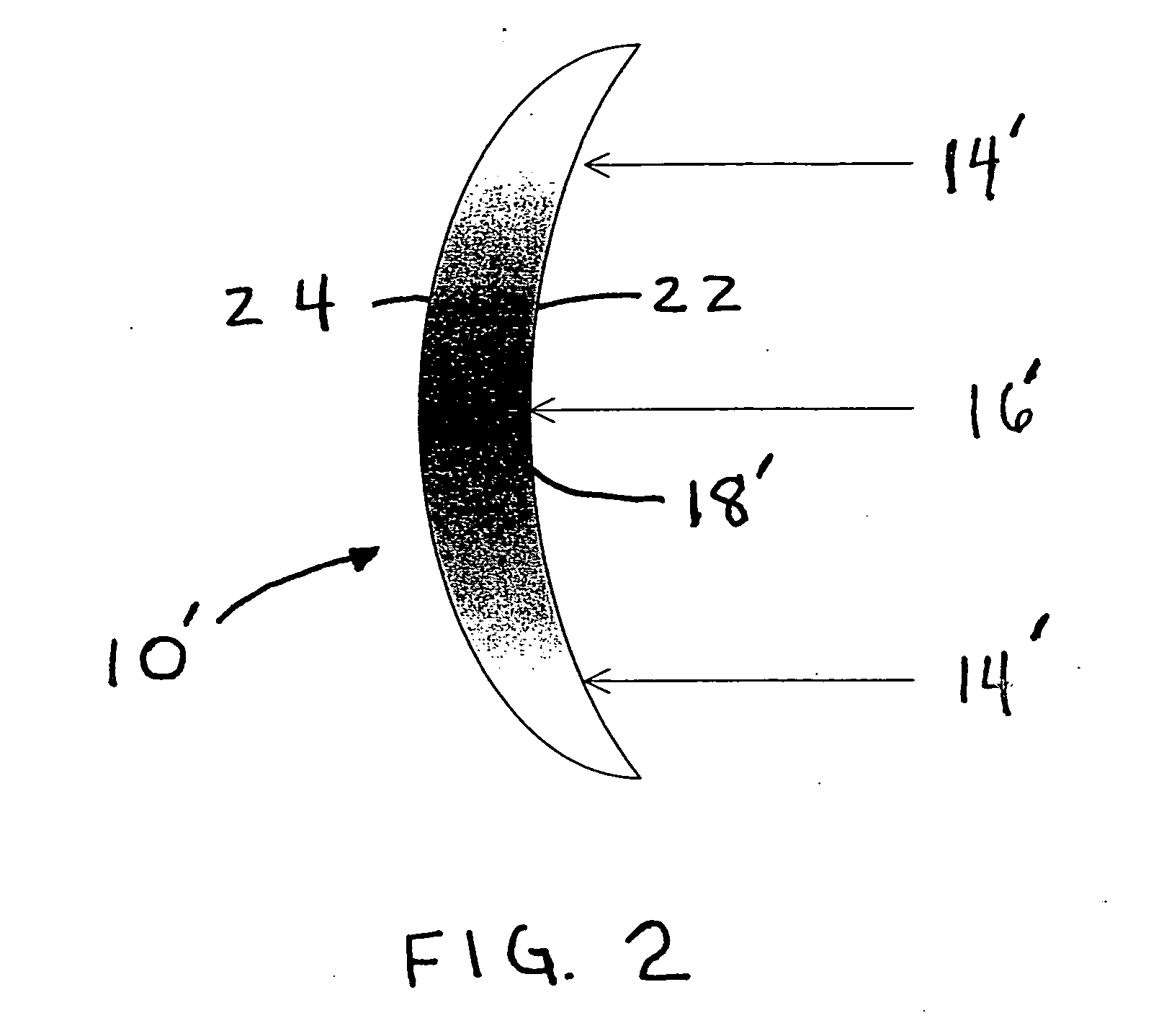 Infinite refractive index gradient (IRIG) polymers for ocular implant and contact lens applications