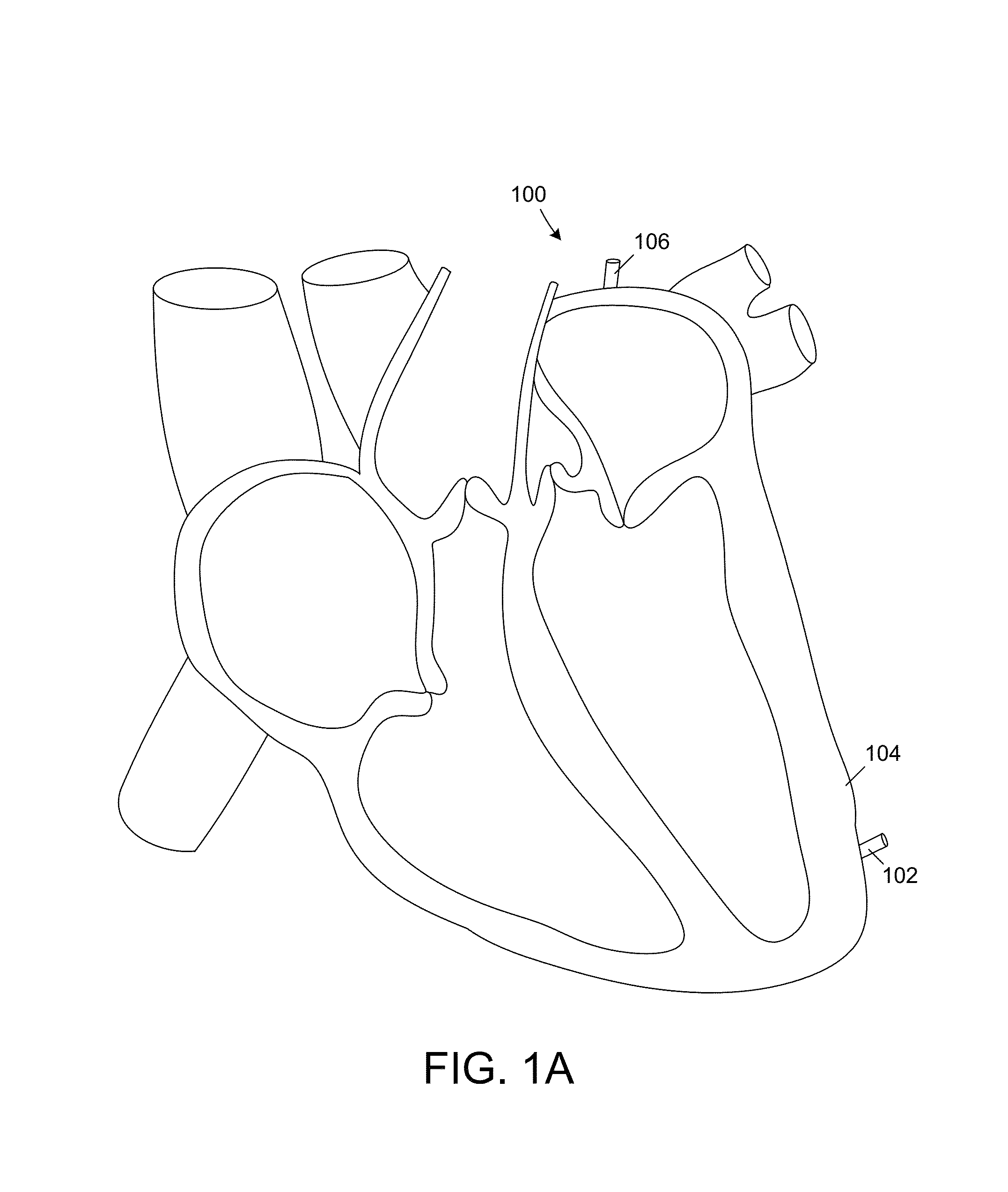 Leadless cardiac pacemaker with conducted communication