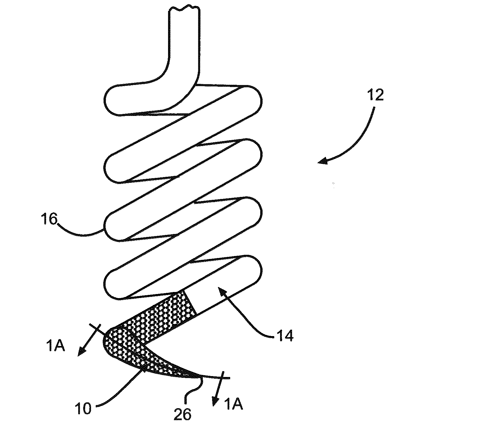 Iridium Oxide Coating with Cauliflower Morphology for Functional Electrical Stimulation Applications