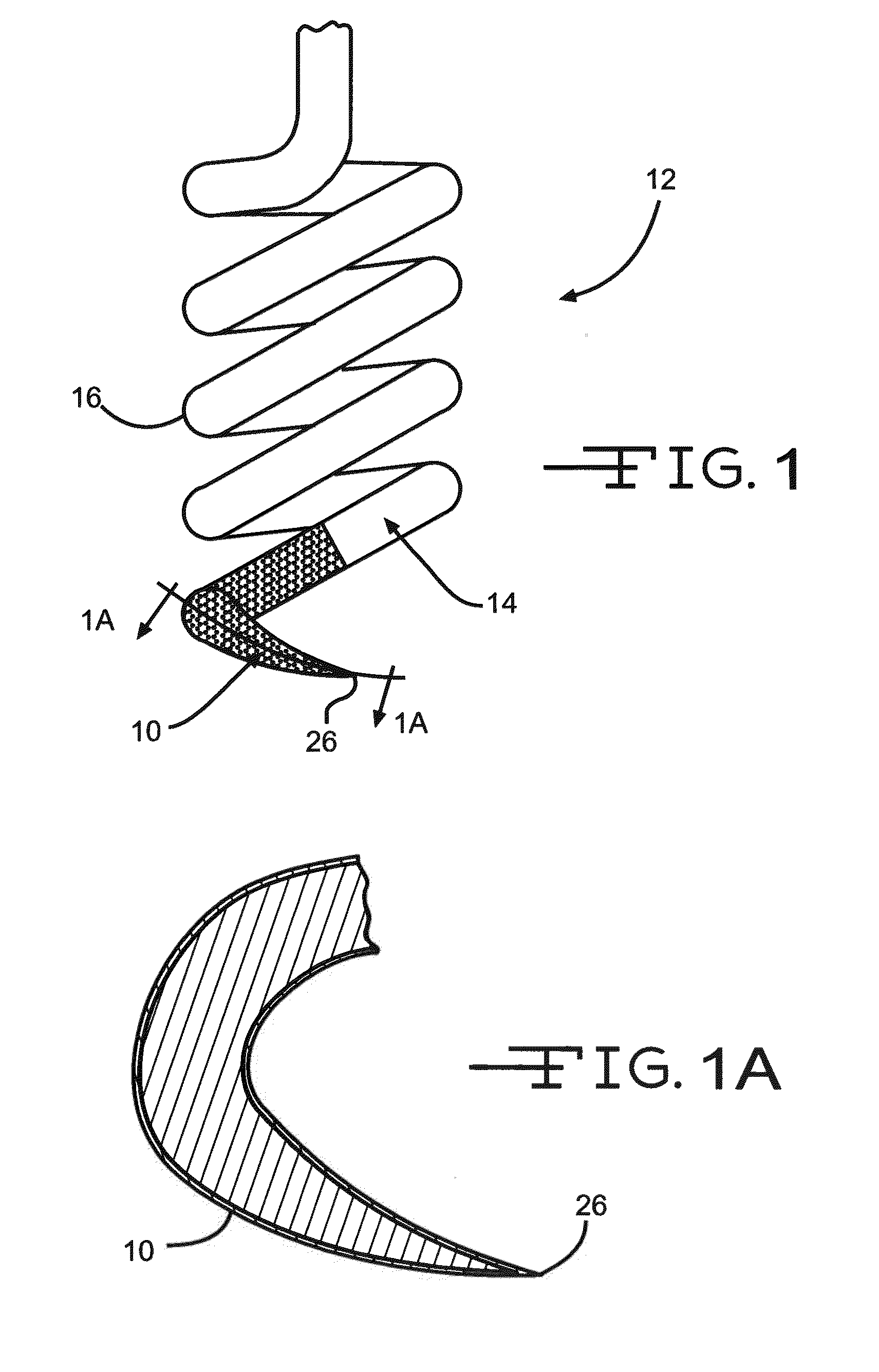 Iridium Oxide Coating with Cauliflower Morphology for Functional Electrical Stimulation Applications