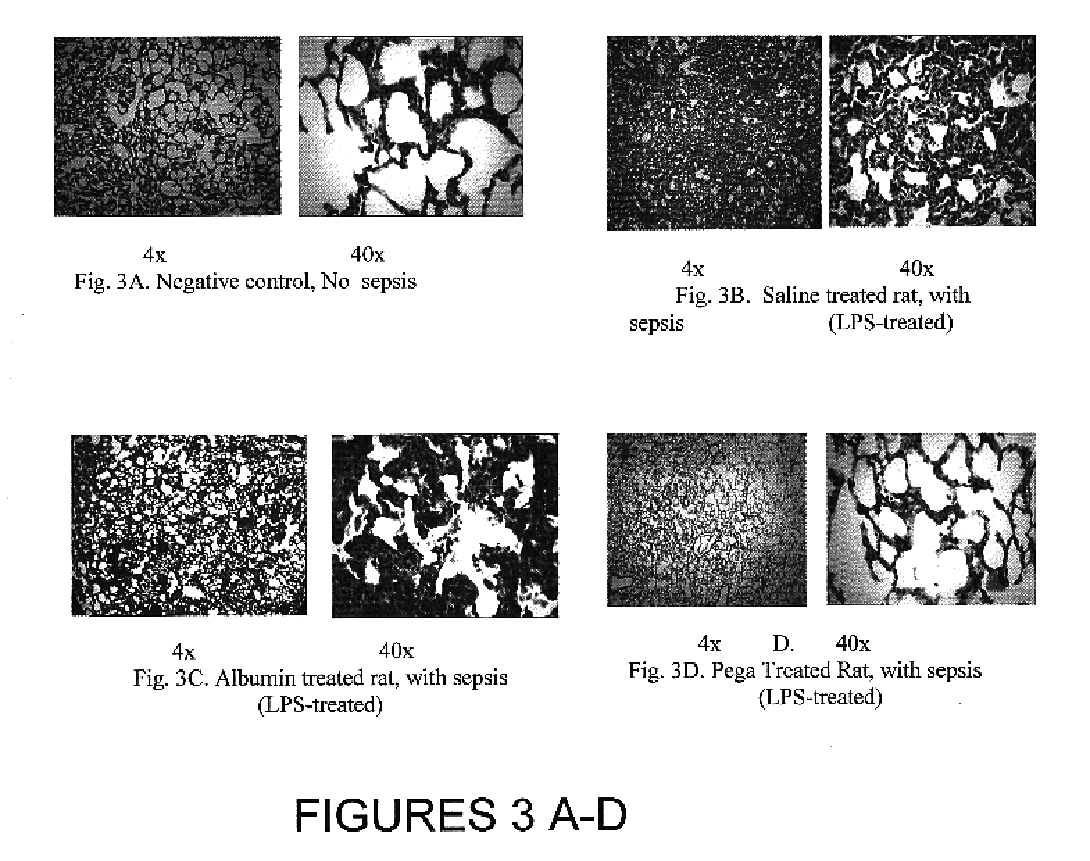 Albumin-based colloid composition and method of use in treating hypovolemia and multiorgan dysfunction