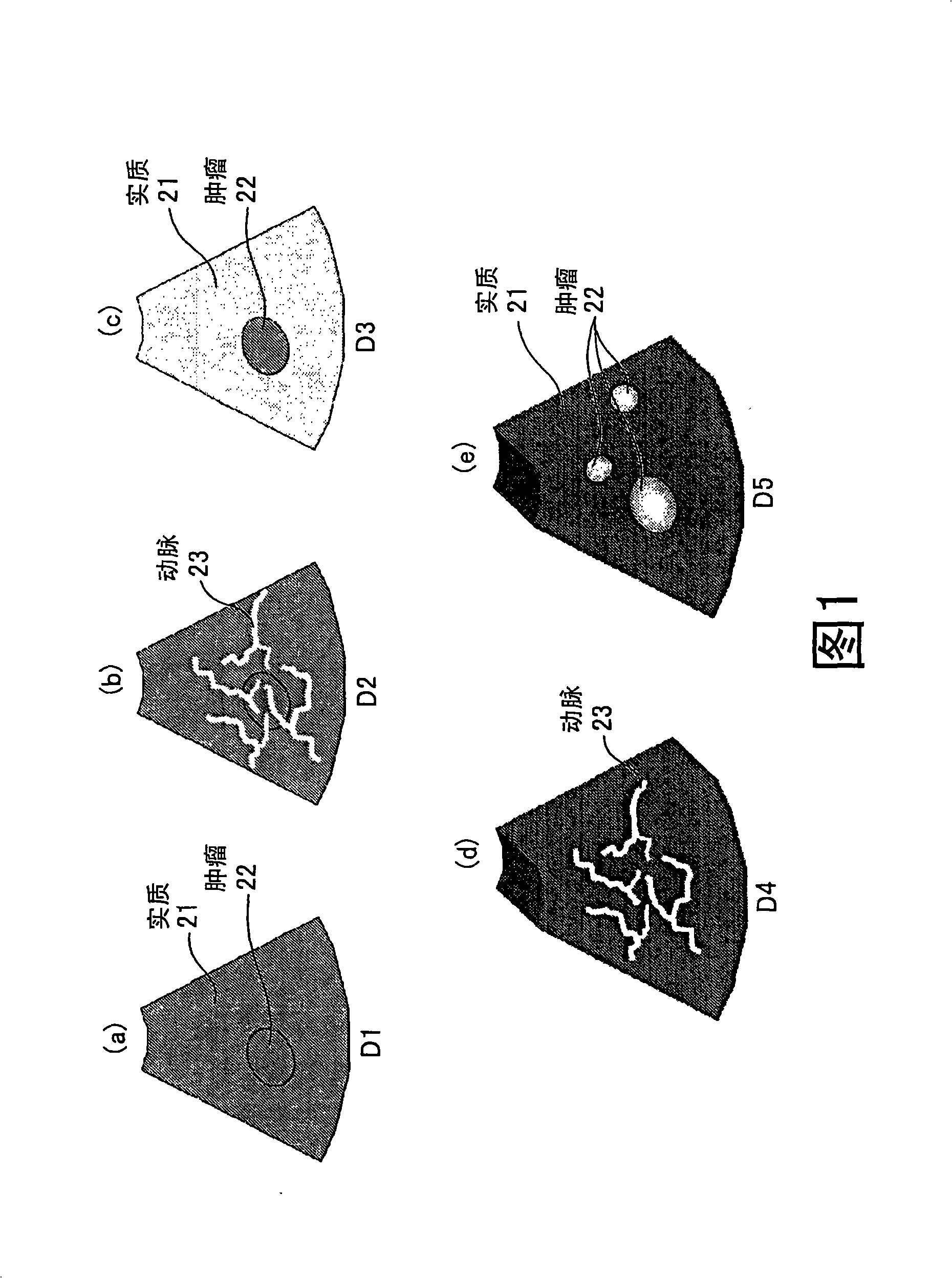 Imaging apparatus, medical image processing apparatus, and medical image processing method