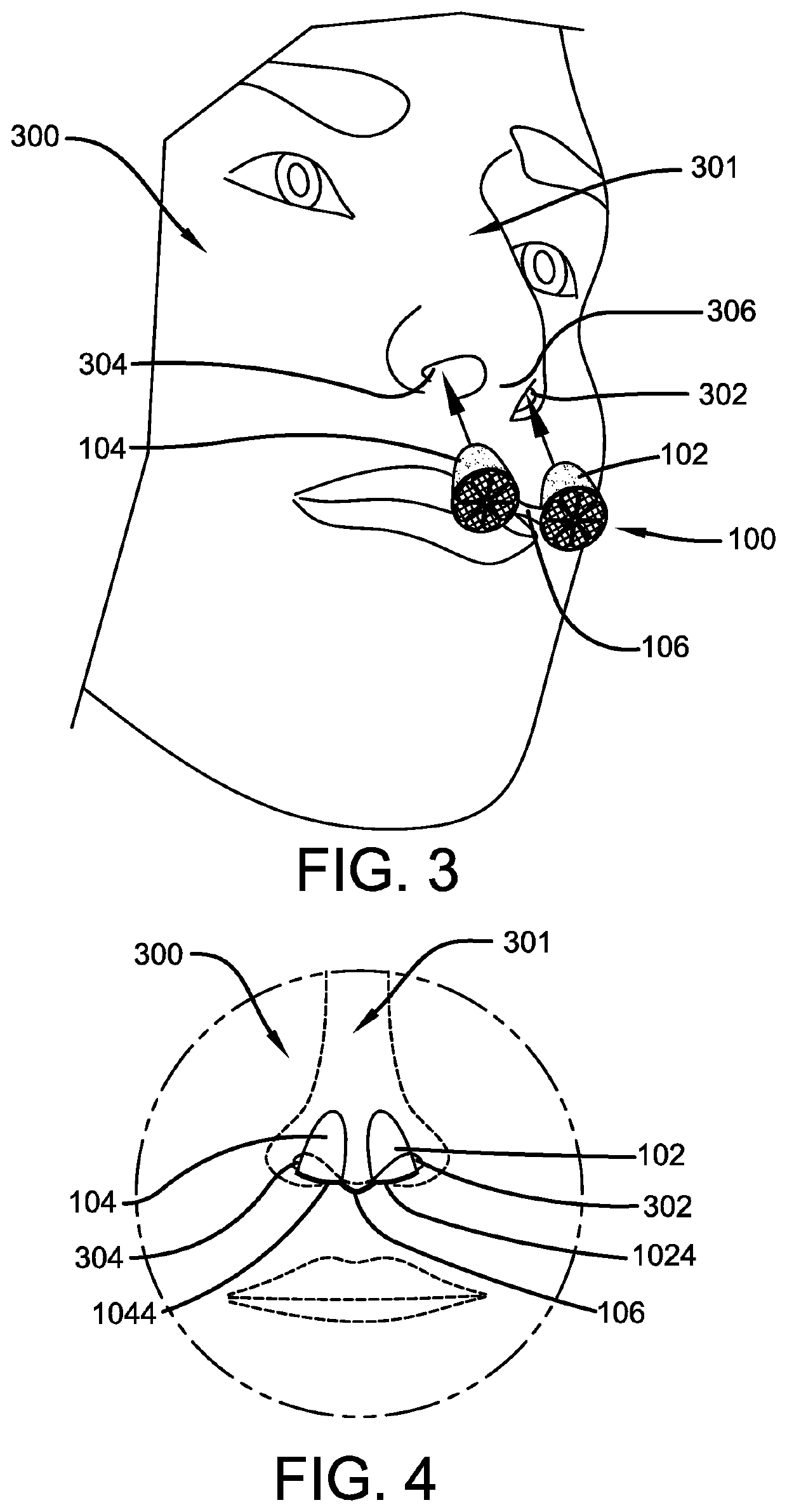 Nose Filtering Device